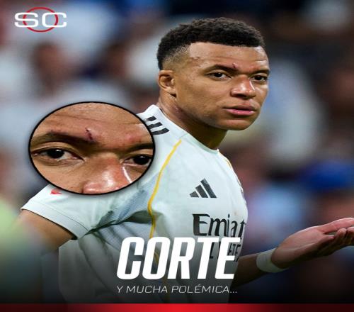 巴萨不满草,坪问题,马竞高层视,金年会官网,金年会平台,金年会体育,金年会APP